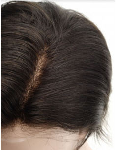 PROTESI CABELLO S7M 2